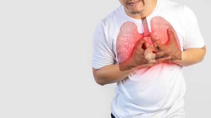 Tuberkulosis